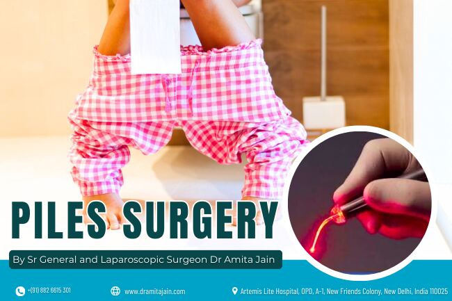 Laparoscopic Surgeon Dr Amita Jain Dr Amita Jain Leading laparoscopic piles Surgeon in Delhi